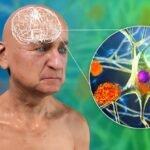 Decades of Alzheimer's