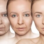 Premature Aging